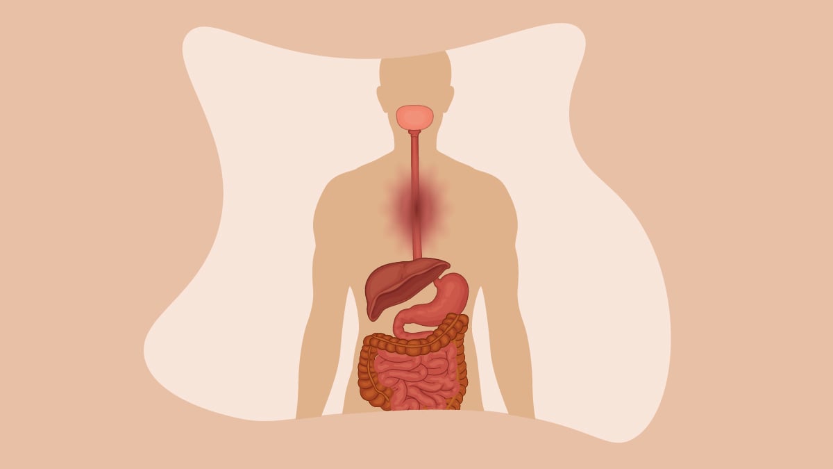 human anatomy acid reflux illustration on a pink background