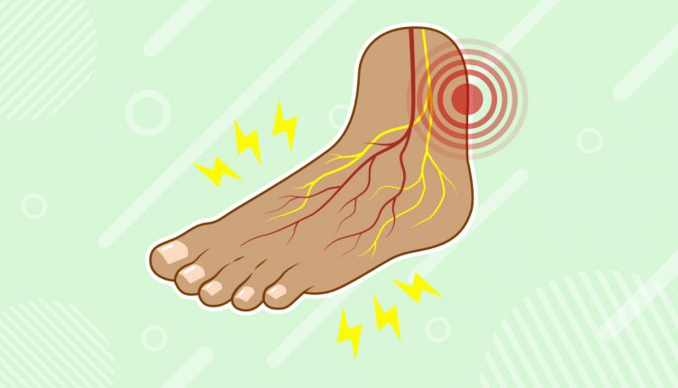 illustration of tendonitis