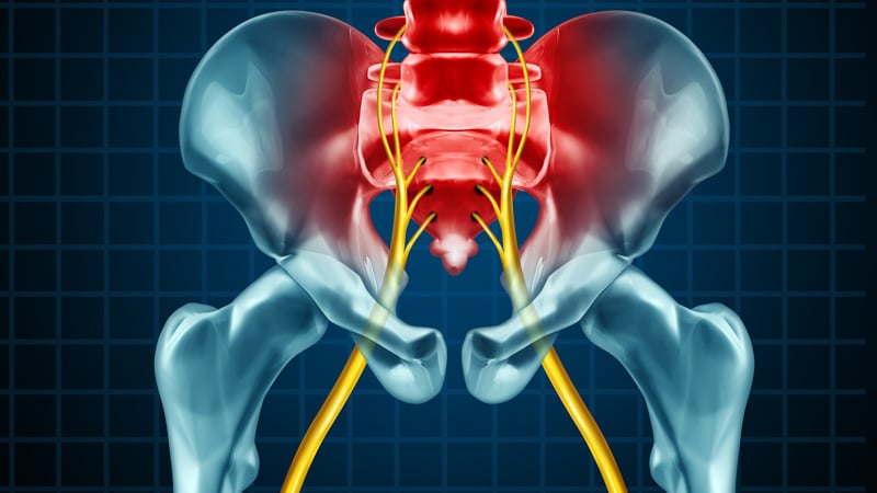 sciatica 3D illustration