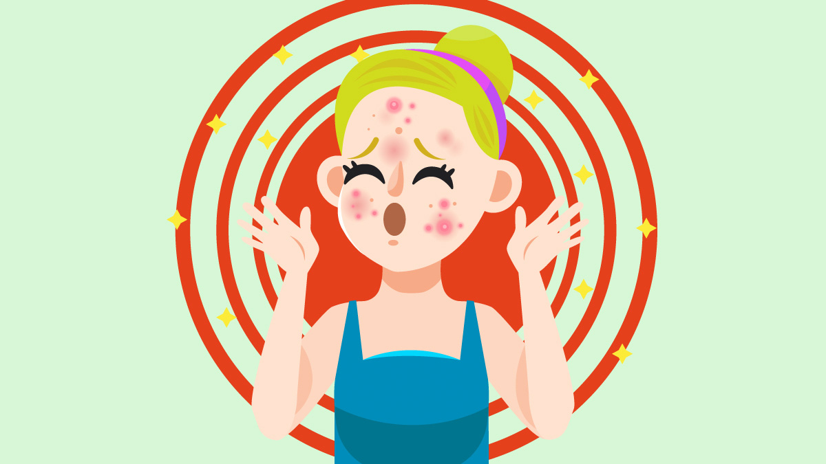 CBD for Acne and Pimple Illustration