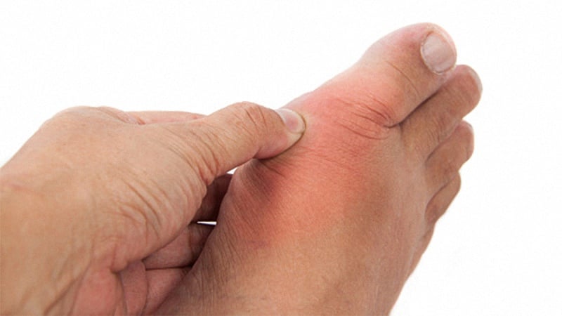 Gout Problem